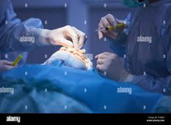 Escarmouche sur une table dopration de chirurgie esthtique par Jingjing Bao