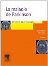 La maladie de Parkinson par Defebvre